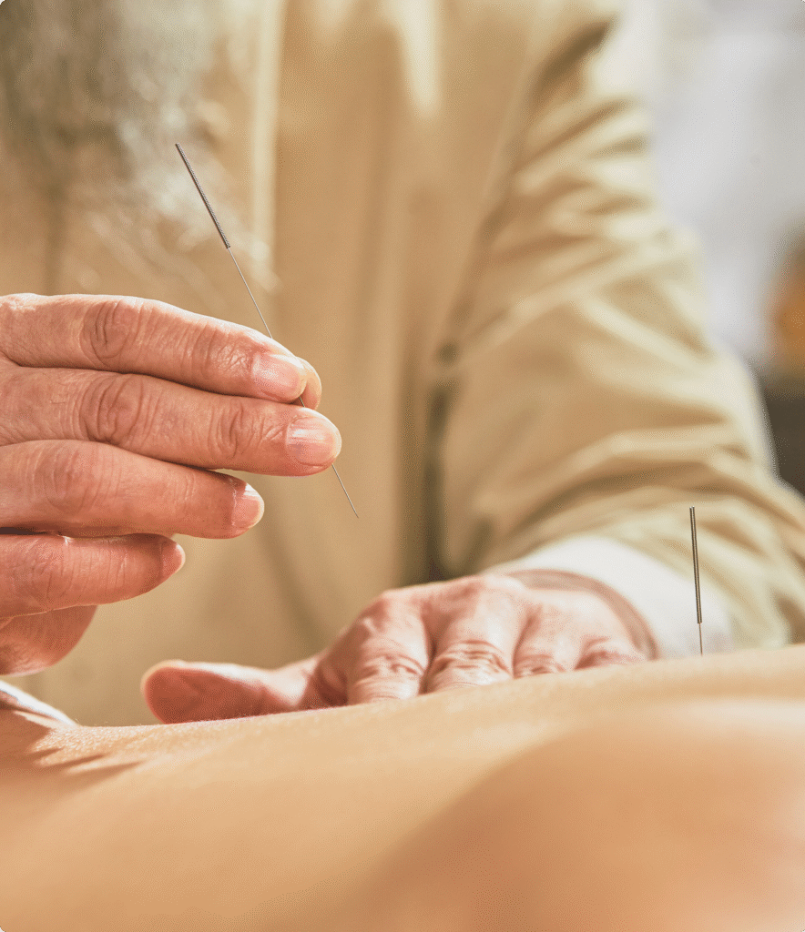 Welcome to AcuVeda- A Journey Back to Tradition