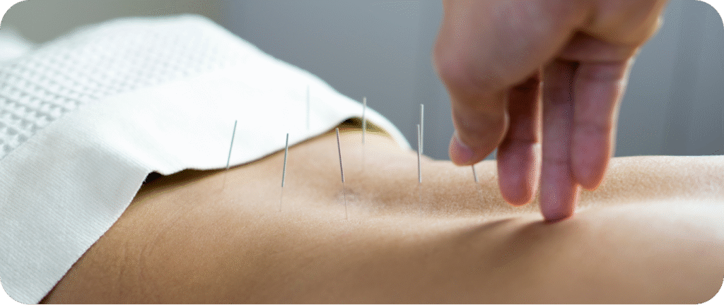 AcuVeda Treatment Center