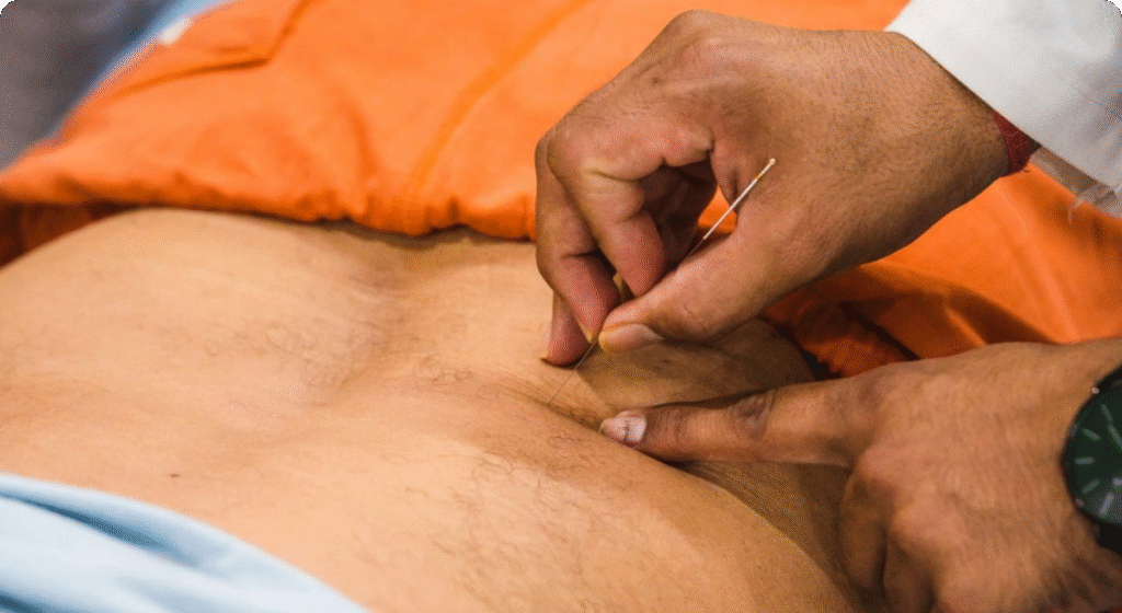 Best Orthopaedic Acupuncture Workshop in India by AcuVeda